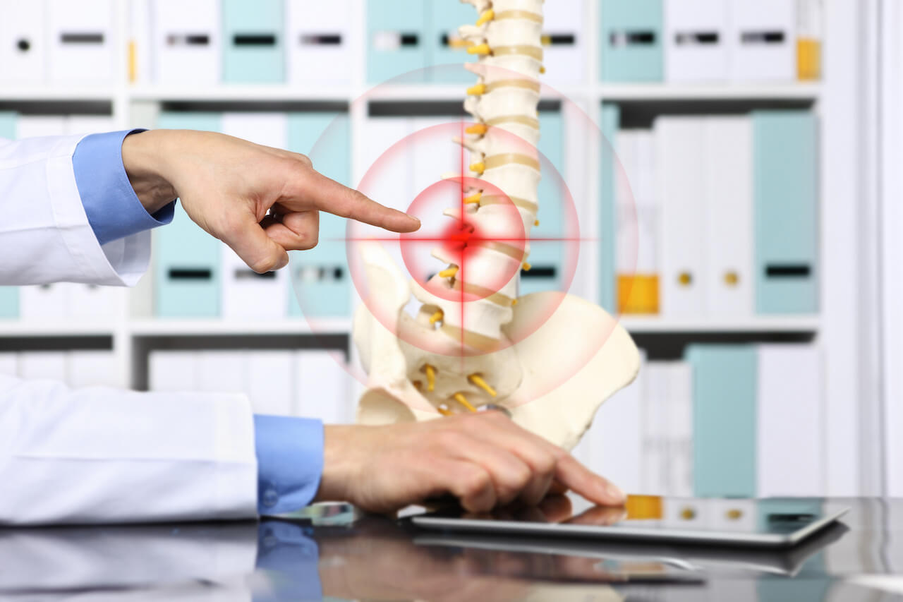 Herniated Discs: Could This be Causing Your Back Pain?