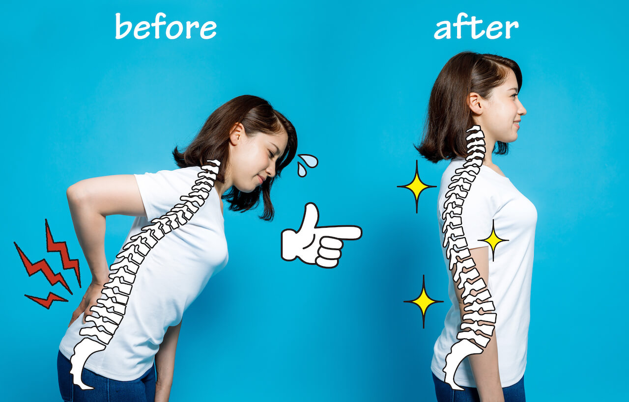 Good posture and bad posture, woman's body silhouette and backbone, chiropractic before after concept.